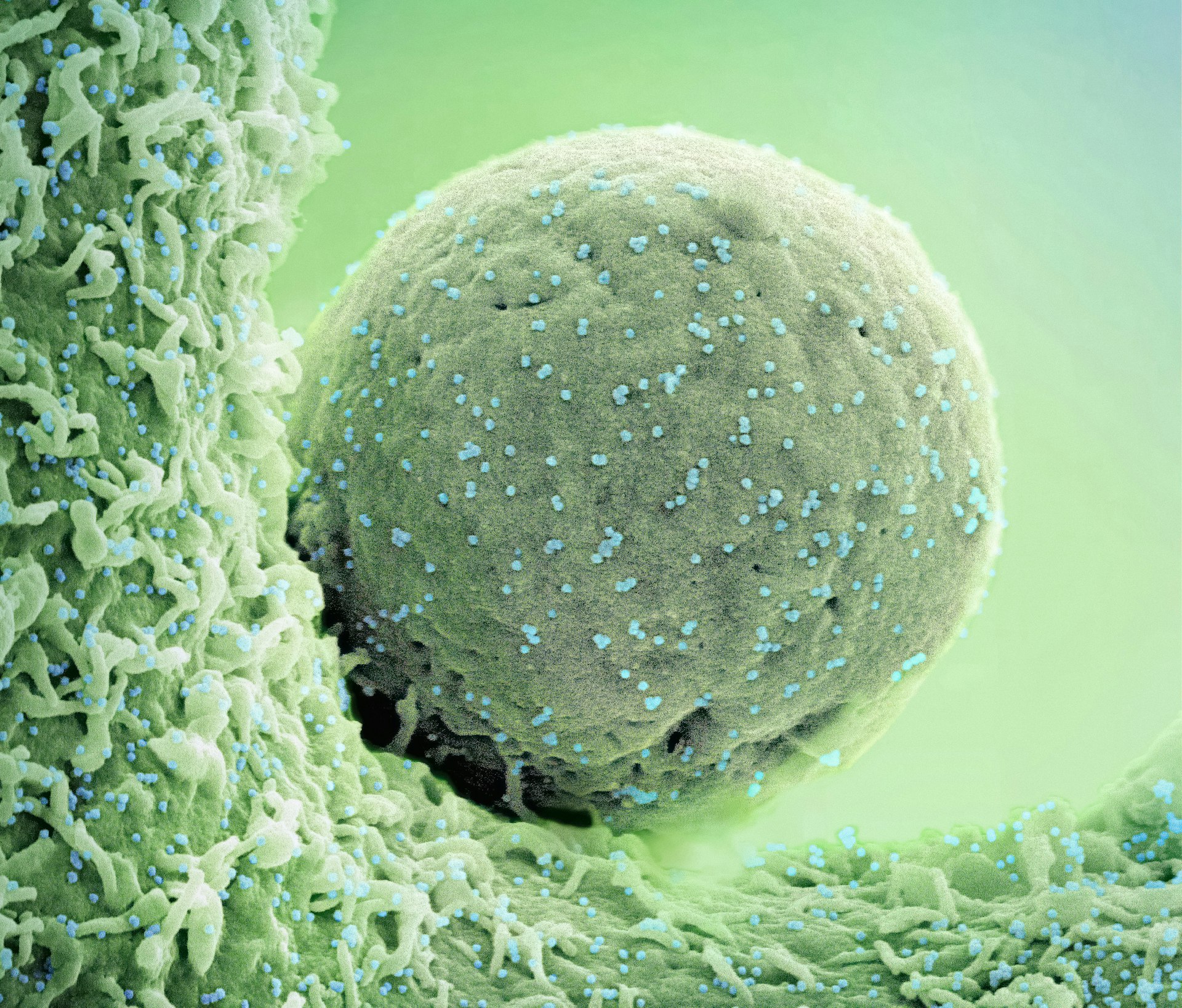 Transforming Healthcare: The Next Decade of Stem Cell Therapies